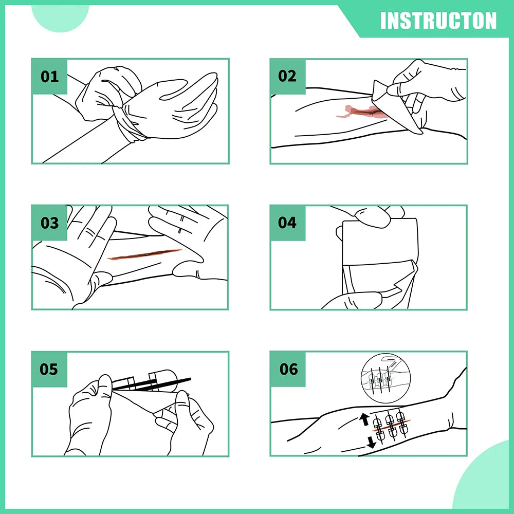 Zip Stitch Wound Closure Kit 6pcs