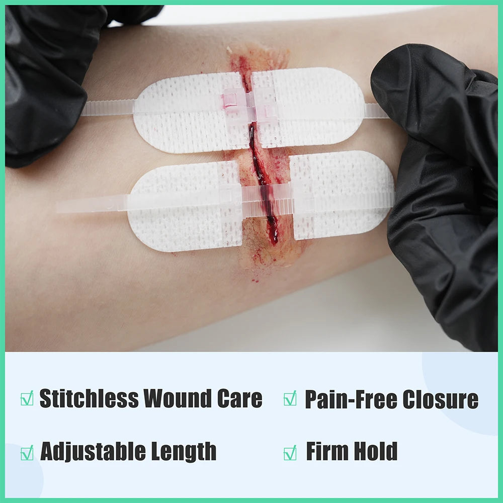 Zip Stitch Wound Closure Kit 6pcs